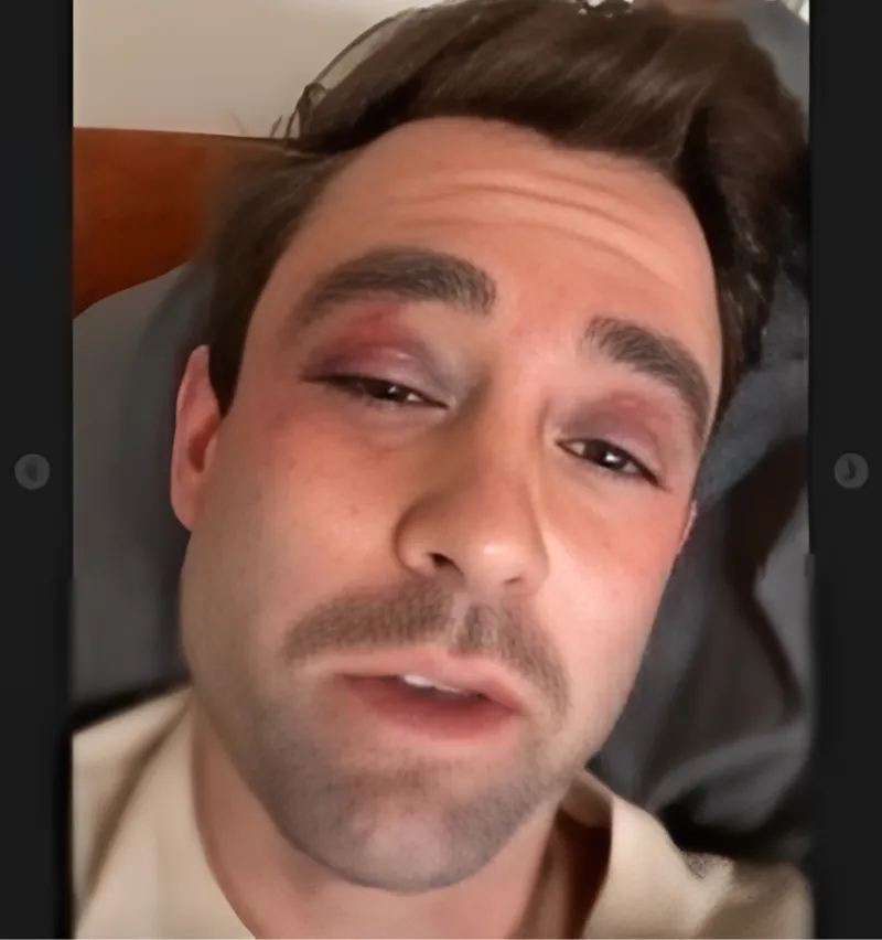 Adam Klotz Public Incidents